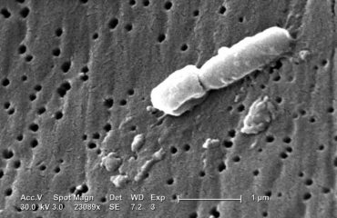 Klebsiella-pneumoniae